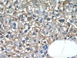 L-VOCC Rabbit anti-Human, Mouse, Rat, Polyclonal, Proteintech 150 &mu;L;