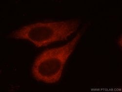 Ataxin 2 Rabbit anti-Human, Mouse, Rat, Polyclonal, Proteintech 150 &mu;L;