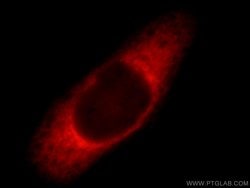 Ataxin 2 Rabbit anti-Human, Mouse, Rat, Polyclonal, Proteintech 150 &mu;L;