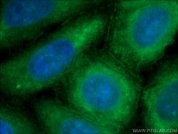Ataxin 2 Rabbit anti-Human, Mouse, Rat, Polyclonal, Proteintech 150 &mu;L;