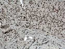 Ataxin 2 Rabbit anti-Human, Mouse, Rat, Polyclonal, Proteintech 150 &mu;L;