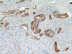 Ataxin 2 Rabbit anti-Human, Mouse, Rat, Polyclonal, Proteintech 150 &mu;L;