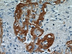 Ataxin 2 Rabbit anti-Human, Mouse, Rat, Polyclonal, Proteintech 150 &mu;L;