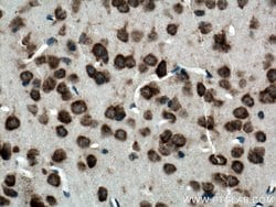 Ataxin 2 Rabbit anti-Human, Mouse, Rat, Polyclonal, Proteintech 150 &mu;L;