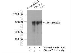 Ataxin 2 Rabbit anti-Human, Mouse, Rat, Polyclonal, Proteintech 150 &mu;L;