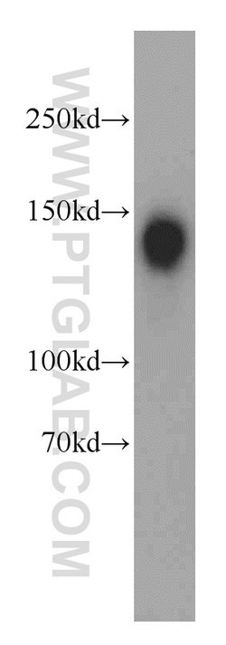 Ataxin 2 Rabbit anti-Human, Mouse, Rat, Polyclonal, Proteintech 150 &mu;L;