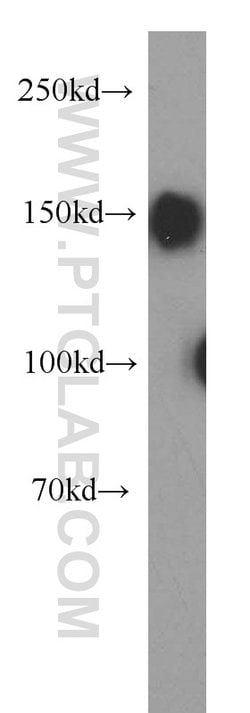 Ataxin 2 Rabbit anti-Human, Mouse, Rat, Polyclonal, Proteintech 150 &mu;L;