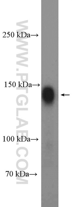 Ataxin 2 Rabbit anti-Human, Mouse, Rat, Polyclonal, Proteintech 150 &mu;L;