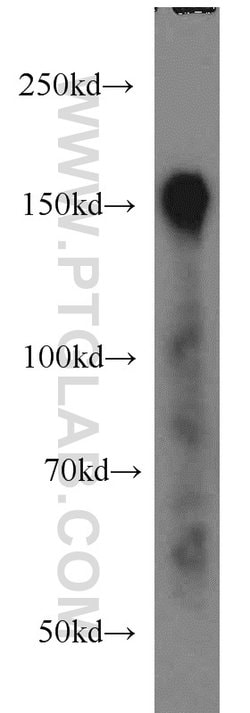 Ataxin 2 Rabbit anti-Human, Mouse, Rat, Polyclonal, Proteintech 150 &mu;L;
