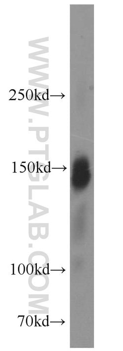 Ataxin 2 Rabbit anti-Human, Mouse, Rat, Polyclonal, Proteintech 150 &mu;L;