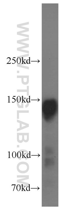 Ataxin 2 Rabbit anti-Human, Mouse, Rat, Polyclonal, Proteintech 150 &mu;L;