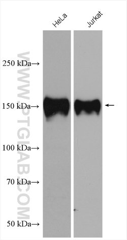Ataxin 2 Rabbit anti-Human, Mouse, Rat, Polyclonal, Proteintech 150 &mu;L;