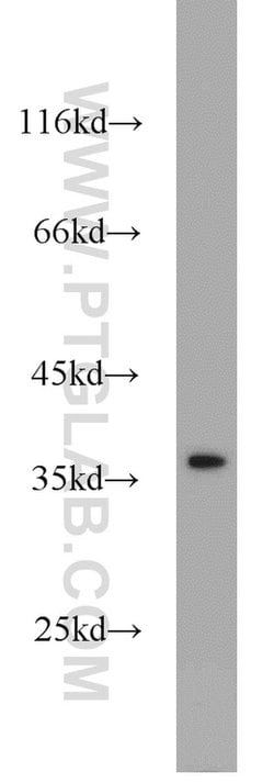 TTF1/NKX2-1 Rabbit anti-Human, Polyclonal, Proteintech:Antibodies:Primary