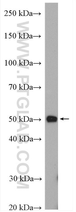 TTF1/NKX2-1 Rabbit anti-Human, Polyclonal, Proteintech:Antibodies:Primary