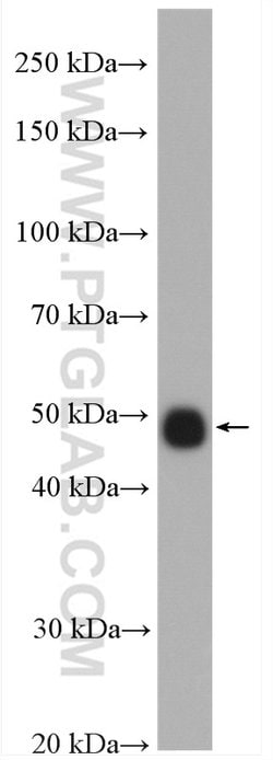 TTF1/NKX2-1 Rabbit anti-Human, Polyclonal, Proteintech:Antibodies:Primary
