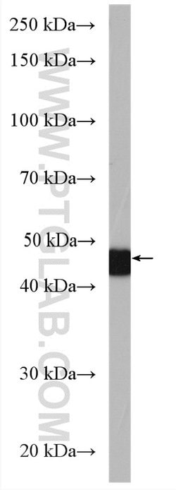 TTF1/NKX2-1 Rabbit anti-Human, Polyclonal, Proteintech:Antibodies:Primary