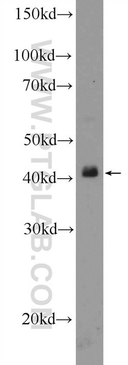 TTF1/NKX2-1 Rabbit anti-Human, Polyclonal, Proteintech:Antibodies:Primary
