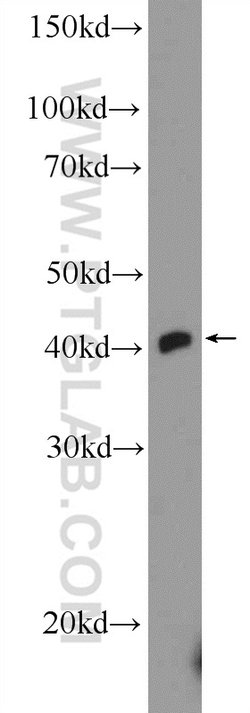 TTF1/NKX2-1 Rabbit anti-Human, Polyclonal, Proteintech:Antibodies:Primary