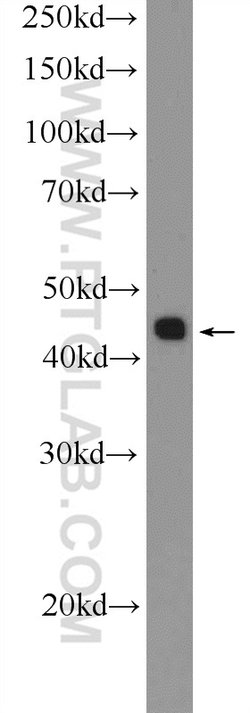 TTF1/NKX2-1 Rabbit anti-Human, Polyclonal, Proteintech:Antibodies:Primary