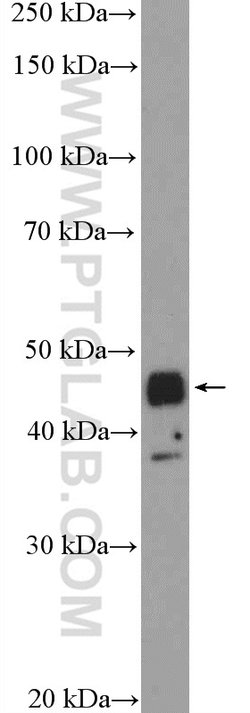 TTF1/NKX2-1 Rabbit anti-Human, Polyclonal, Proteintech:Antibodies:Primary