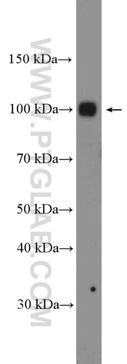 EZH2 Rabbit anti-Human, Mouse, Rat, Polyclonal, Proteintech:  