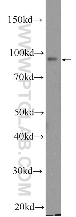 EZH2 Rabbit anti-Human, Mouse, Rat, Polyclonal, Proteintech:  