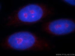 ZNF74 Rabbit anti-Human, Mouse, Rat, Polyclonal, Proteintech 150 &mu;L | Buy Online | Proteintech Group Inc | Fisher Scientific