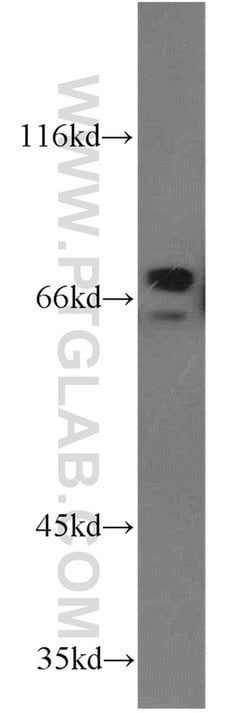 ZNF74 Rabbit anti-Human, Mouse, Rat, Polyclonal, Proteintech 150 &mu;L | Buy Online | Proteintech Group Inc | Fisher Scientific