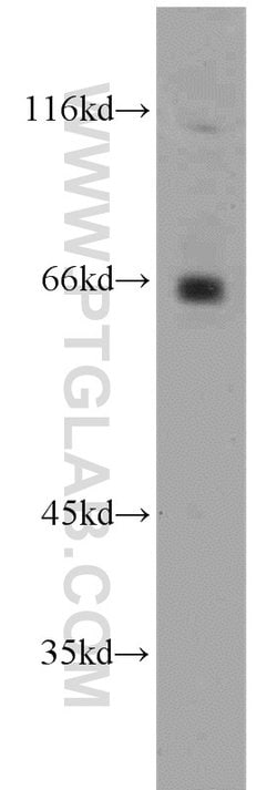 ZNF74 Rabbit anti-Human, Mouse, Rat, Polyclonal, Proteintech 150 &mu;L | Buy Online | Proteintech Group Inc | Fisher Scientific