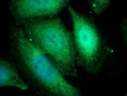 ROCK1 Rabbit anti-Human, Mouse, Rat, Polyclonal, Proteintech 150 &mu;L;