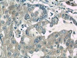 ROCK1 Rabbit anti-Human, Mouse, Rat, Polyclonal, Proteintech 150 &mu;L;