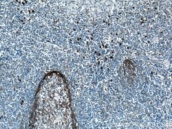 CD11B/Integrin alpha M Rabbit anti-Human, Polyclonal, Proteintech 20 &mu;L;