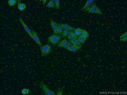 SOAT2 Rabbit anti-Human, Polyclonal, Proteintech 150 &mu;L; Unconjugated:Antibodies,