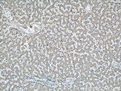SOAT2 Rabbit anti-Human, Polyclonal, Proteintech 150 &mu;L; Unconjugated:Antibodies,