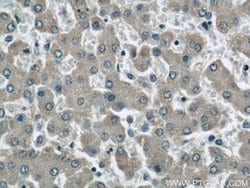 SOAT2 Rabbit anti-Human, Polyclonal, Proteintech 150 &mu;L; Unconjugated:Antibodies,