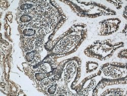 SOAT2 Rabbit anti-Human, Polyclonal, Proteintech 150 &mu;L; Unconjugated:Antibodies,