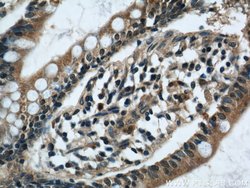SOAT2 Rabbit anti-Human, Polyclonal, Proteintech 150 &mu;L; Unconjugated:Antibodies,