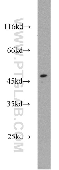 SOAT2 Rabbit anti-Human, Polyclonal, Proteintech 150 &mu;L; Unconjugated:Antibodies,
