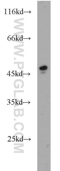 SOAT2 Rabbit anti-Human, Polyclonal, Proteintech 150 &mu;L; Unconjugated:Antibodies,