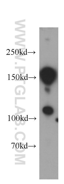 KIDINS220 Rabbit anti-Human, Mouse, Rat, Polyclonal, Proteintech 150 &mu;L;