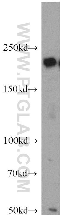 KIDINS220 Rabbit anti-Human, Mouse, Rat, Polyclonal, Proteintech 150 &mu;L;
