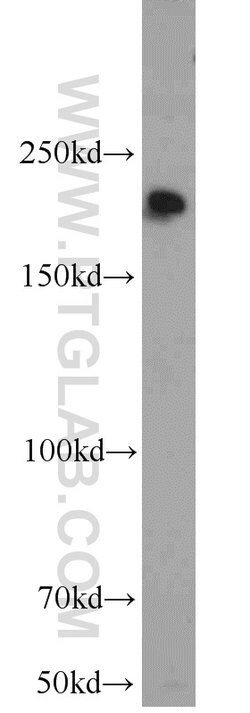 KIDINS220 Rabbit anti-Human, Mouse, Rat, Polyclonal, Proteintech 150 &mu;L;