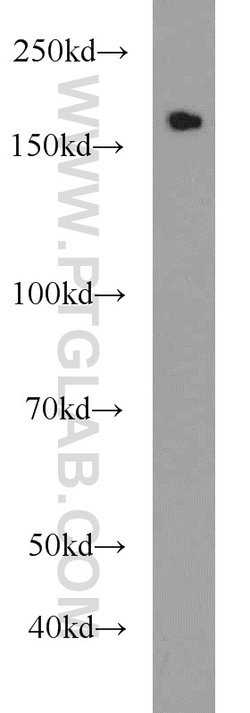 KIDINS220 Rabbit anti-Human, Mouse, Rat, Polyclonal, Proteintech 150 &mu;L;