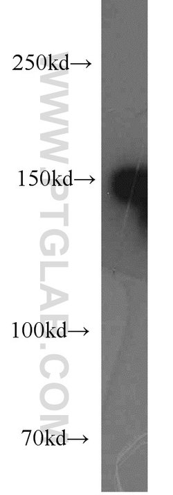 SAFB Rabbit anti-Human, Polyclonal, Proteintech:Antibodies:Primary Antibodies