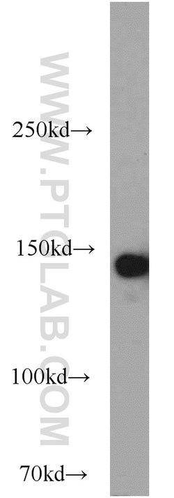 SAFB Rabbit anti-Human, Polyclonal, Proteintech:Antibodies:Primary Antibodies