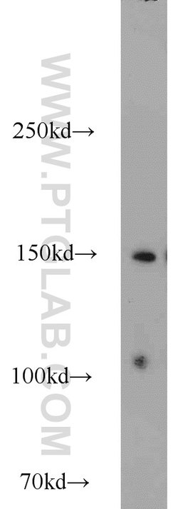SAFB Rabbit anti-Human, Polyclonal, Proteintech:Antibodies:Primary Antibodies