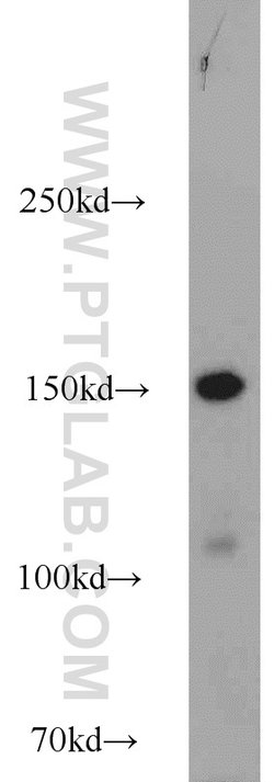 SAFB Rabbit anti-Human, Polyclonal, Proteintech:Antibodies:Primary Antibodies