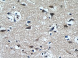 TCERG1 Rabbit anti-Human, Mouse, Rat, Polyclonal, Proteintech 150 &mu;L;