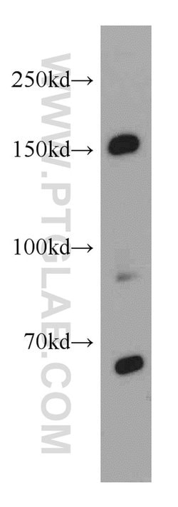 TCERG1 Rabbit anti-Human, Mouse, Rat, Polyclonal, Proteintech 150 &mu;L;