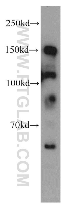 TCERG1 Rabbit anti-Human, Mouse, Rat, Polyclonal, Proteintech 150 &mu;L;